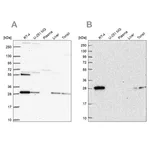 Merck Anti-PMM2 antibody produced in rabbit