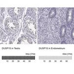 Merck Anti-DUSP15 antibody produced in rabbit