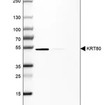 Merck Anti-KRT80 antibody produced in rabbit