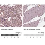 Merck Anti-HTR1B antibody produced in rabbit