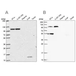 Merck Anti-NOD2 antibody produced in rabbit