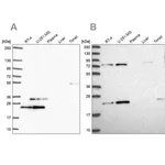 Merck Anti-EIF3K antibody produced in rabbit