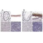 Merck Anti-GRK1 antibody produced in rabbit
