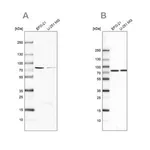 Merck Anti-ATP6V1A antibody produced in rabbit