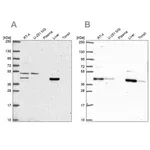 Merck Anti-PHKG2 antibody produced in rabbit