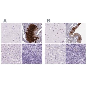 Merck Anti-KRT12 antibody produced in rabbit