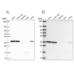 Merck Anti-NUP37 antibody produced in rabbit