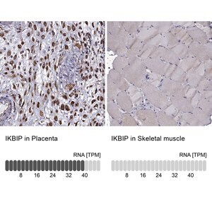 Merck Anti-IKBIP antibody produced in rabbit