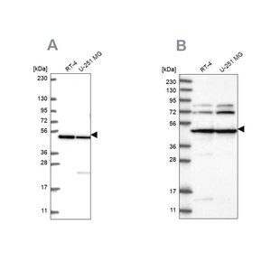 Merck Anti-HADHB antibody produced in rabbit