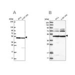 Merck Anti-HADHB antibody produced in rabbit