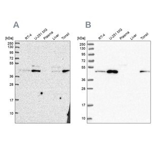 Merck Anti-ZDHHC16 antibody produced in rabbit