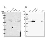 Merck Anti-ZDHHC16 antibody produced in rabbit