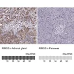 Merck Anti-RIMS2 antibody produced in rabbit