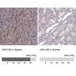 Merck Anti-UNC13D antibody produced in rabbit