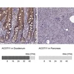 Merck Anti-ACOT11 antibody produced in rabbit