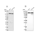 Merck Anti-DDX46 antibody produced in rabbit