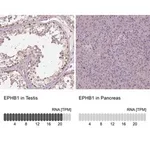 Merck Anti-EPHB1 antibody produced in rabbit