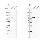 Merck Anti-LARP4B antibody produced in rabbit