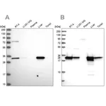 Merck Anti-HADH antibody produced in rabbit