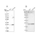 Merck Anti-NOP16 antibody produced in rabbit