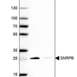 Merck Anti-SNRPB antibody produced in rabbit