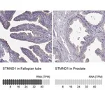 Merck Anti-STMND1 antibody produced in rabbit