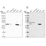 Merck Anti-PHKG2 antibody produced in rabbit