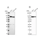 Merck Anti-AP1B1 antibody produced in rabbit