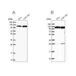 Merck Anti-AARS antibody produced in rabbit