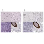 Merck Anti-KRT25 antibody produced in rabbit