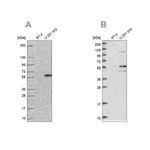 Merck Anti-ACSBG1 antibody produced in rabbit