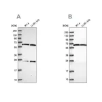 Merck Anti-ACAD9 antibody produced in rabbit