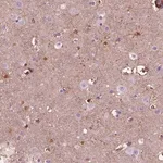 Merck Anti-GDF11 antibody produced in rabbit