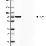 Merck Anti-PAK4 antibody produced in rabbit