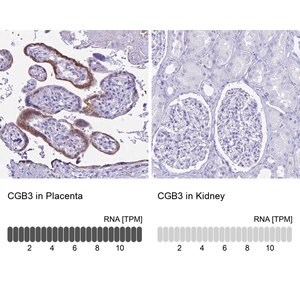 Merck Anti-CGB3 antibody produced in rabbit