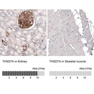 Merck Monoclonal Anti-THSD7A antibody produced in mouse