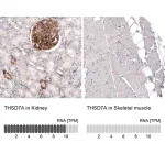 Merck Monoclonal Anti-THSD7A antibody produced in mouse