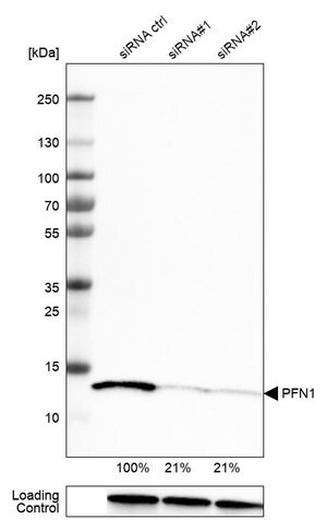 Merck Monoclonal Anti-PFN1 antibody produced in mouse