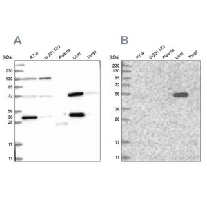 Merck Anti-UGP2 antibody produced in rabbit