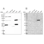 Merck Anti-UGP2 antibody produced in rabbit