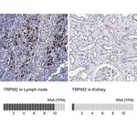 Merck Anti-TRPM2 antibody produced in rabbit