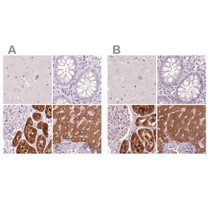 Merck Anti-FTCD antibody produced in rabbit