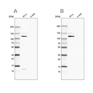 Merck Anti-MCC antibody produced in rabbit