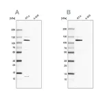 Merck Anti-MCC antibody produced in rabbit