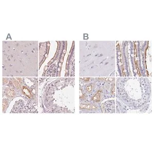 Merck Anti-TREH antibody produced in rabbit