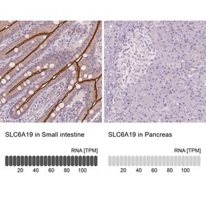 Merck Anti-SLC6A19 antibody produced in rabbit