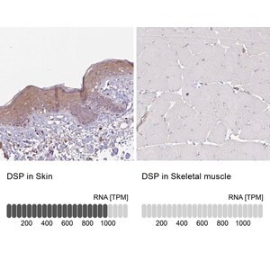 Merck Anti-DSP antibody produced in rabbit