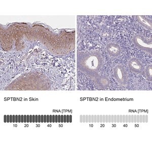 Merck Anti-SPTBN2 antibody produced in rabbit