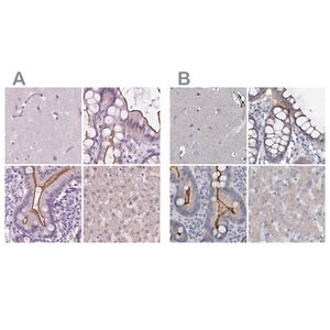 Merck Anti-ACY3 antibody produced in rabbit