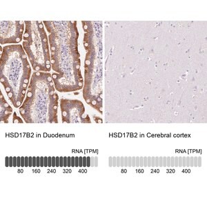 Merck Anti-HSD17B2 antibody produced in rabbit